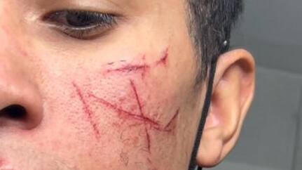 Élan de solidarité sur Instagram après une agression présumée à Neuchâtel Élan de solidarité sur Instagram après une agression présumée à Neuchâtel