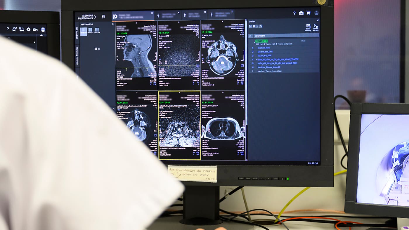 La Suisse à la pointe de l'imagerie médicale en Europe : un boom sans précédent