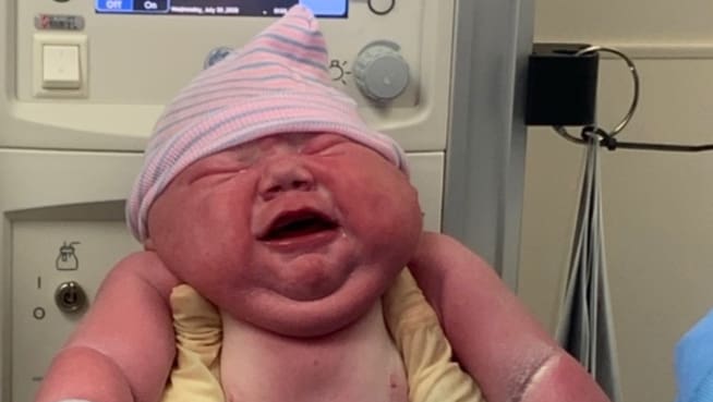 Elle accouche d'un énorme bébé de 6 kilos et choque Internet - Blick
