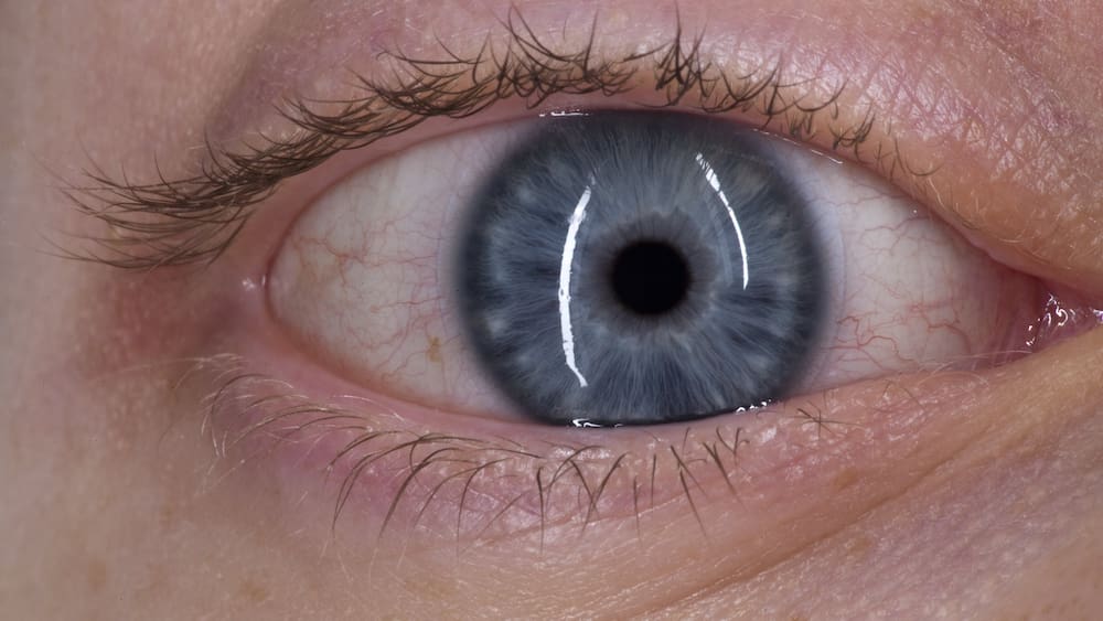 Was sind trockene Augen und was kann man dagegen tun? - Blick