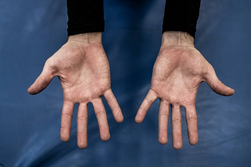 Handball-Nati: Diese Hände sollen es heute in Serbien richten - Blick