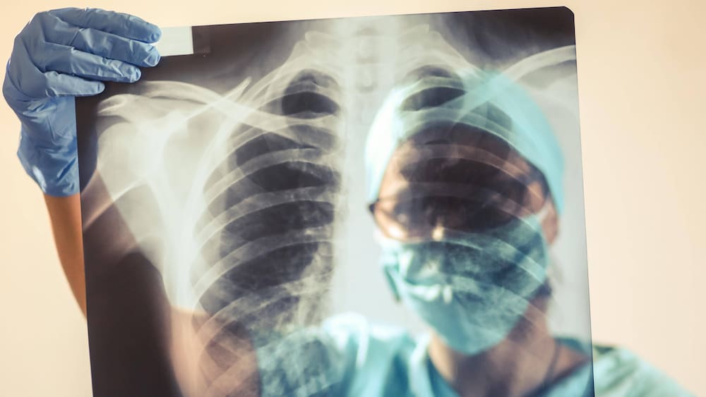 Why corona patients need to be ventilated for so long Why corona patients need to be ventilated for so long