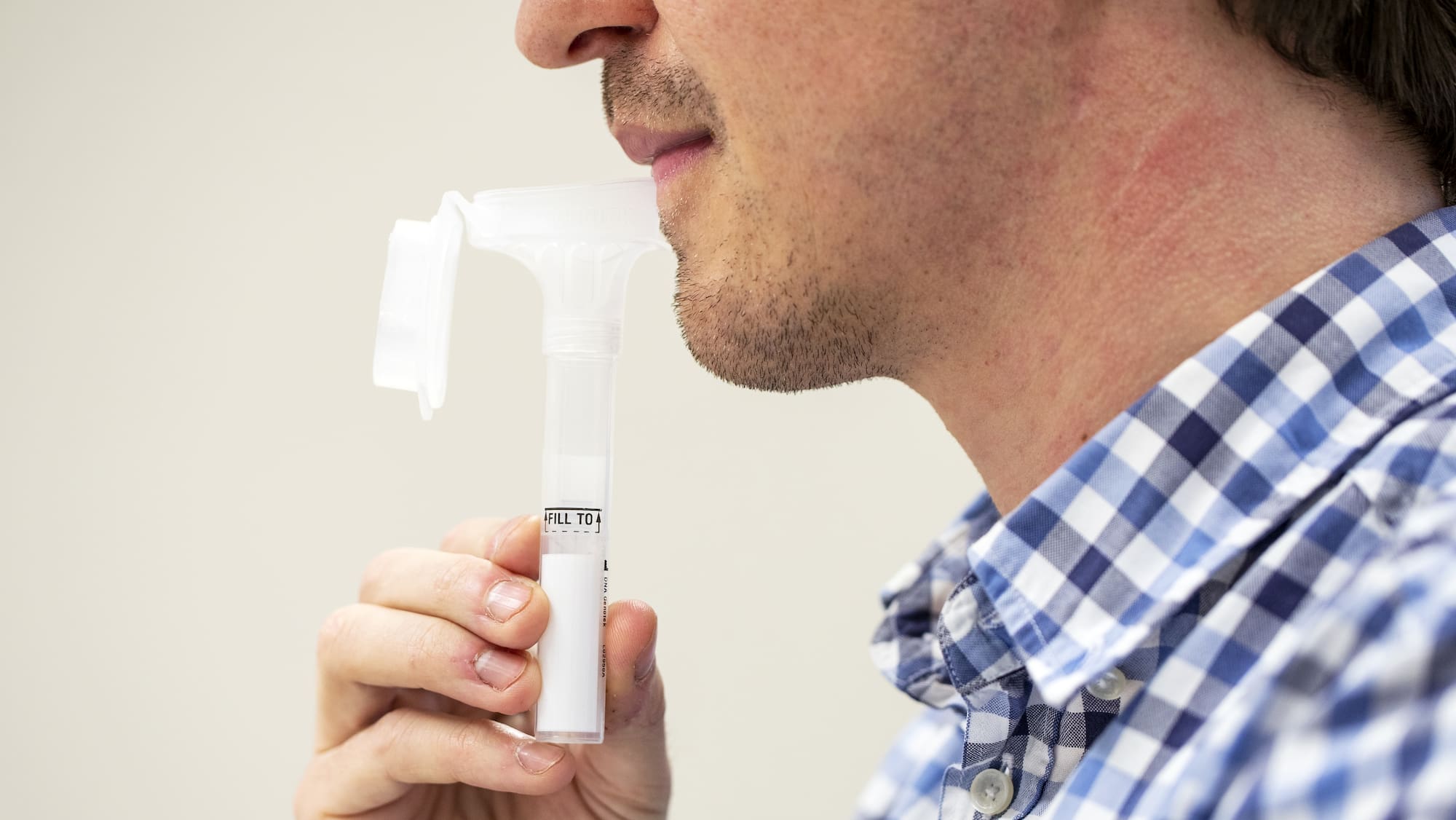 Bern will Spuck-Tests für zu Hause - Blick