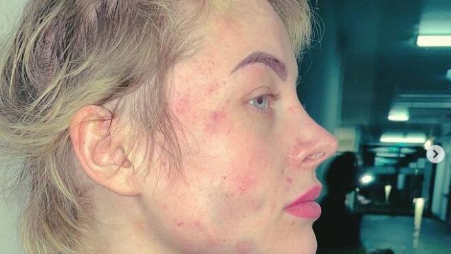 Dsds Star Aline Bachmann Beaten Up By An Ex Boyfriend De24 News English