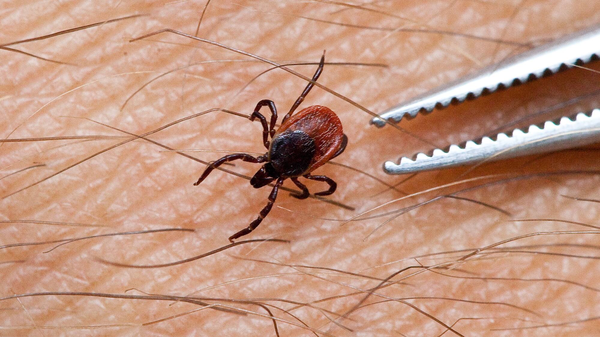 So gefährlich sind Zecken wirklich: Was tun bei Zeckenbiss? - Blick