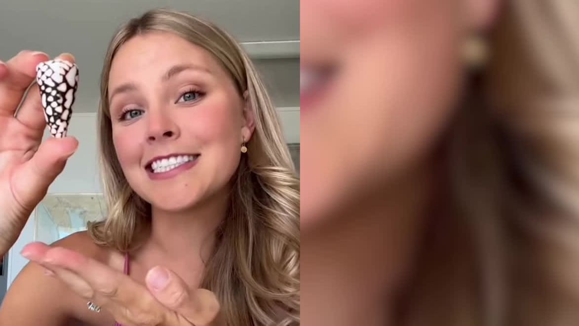 Gefährliche Schönheit: Tiktokerin warnt vor tödlicher Schneckenart aus Japan!