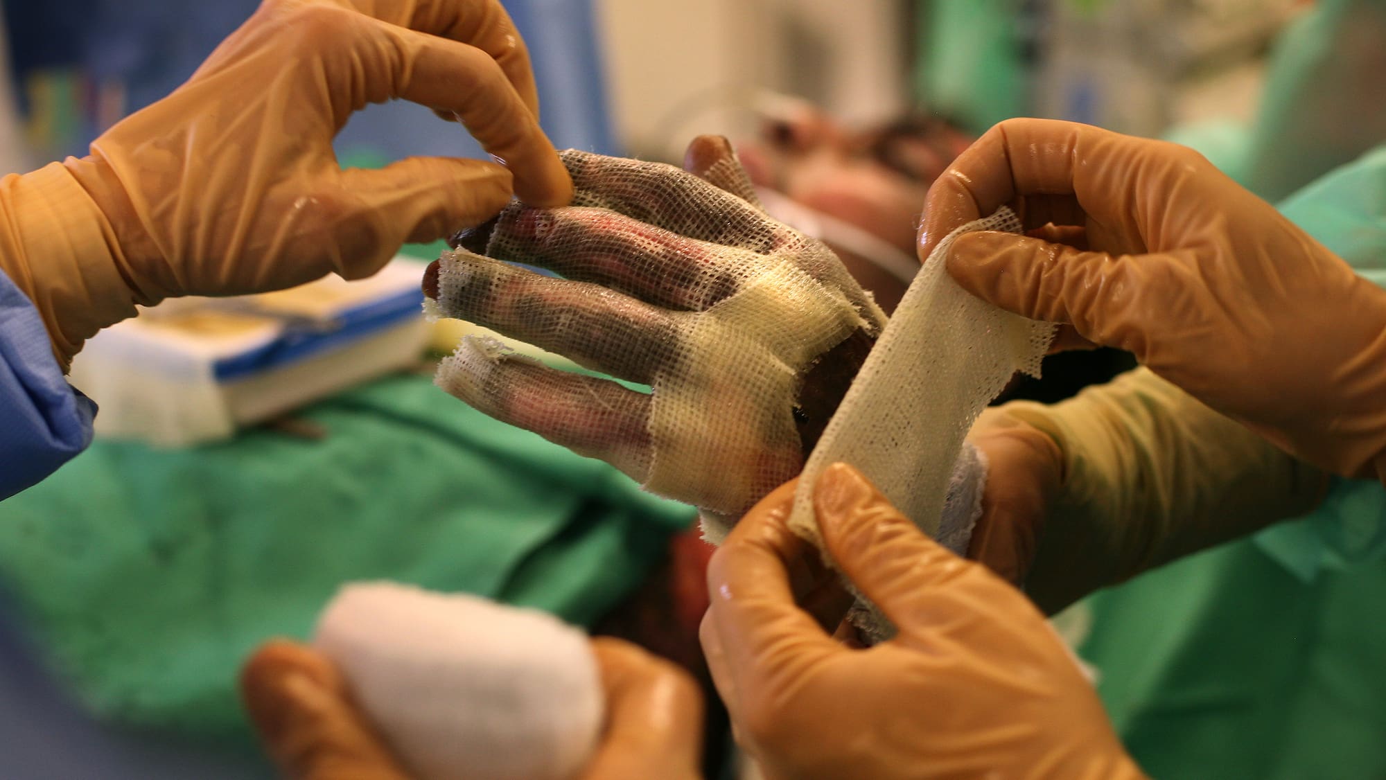 Swiss Hospitals Face Challenges Following Crans-Montana Event Swiss Hospitals Face Challenges Following Crans-Montana Event