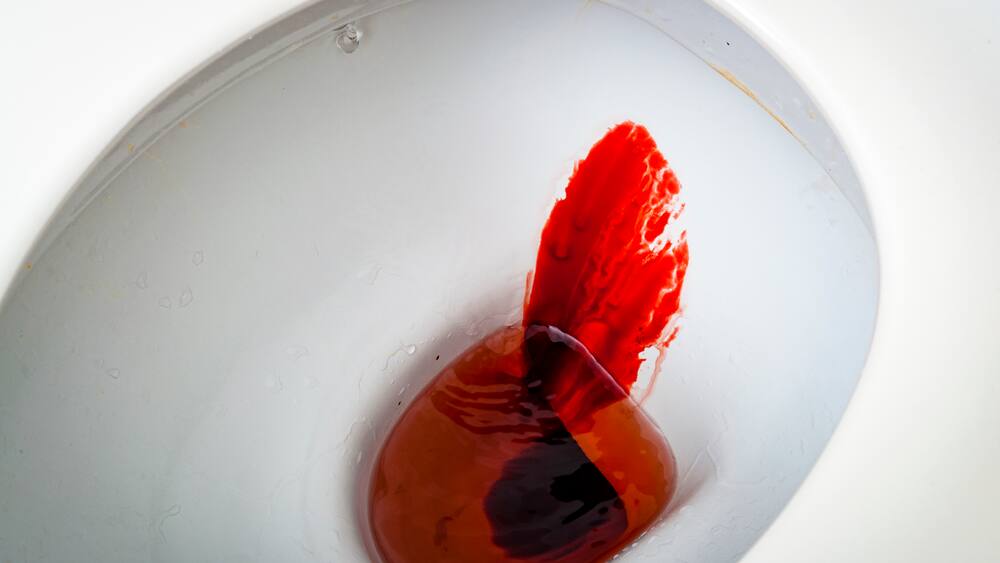 Was Blut im Urin alles bedeuten kann - Blick