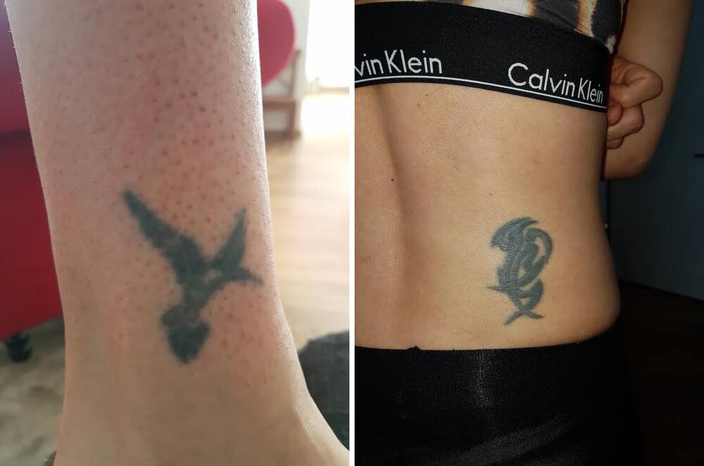 Was Passiert Mit Tattoos Wenn Man Abnimmt www.blick.ch